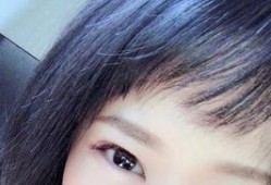 吃哈密瓜脸水肿,揭秘吃哈密瓜引发脸水肿的真相