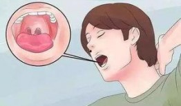 吃瓜吃多了舌头痛怎么办,吃瓜过量后的应急攻略